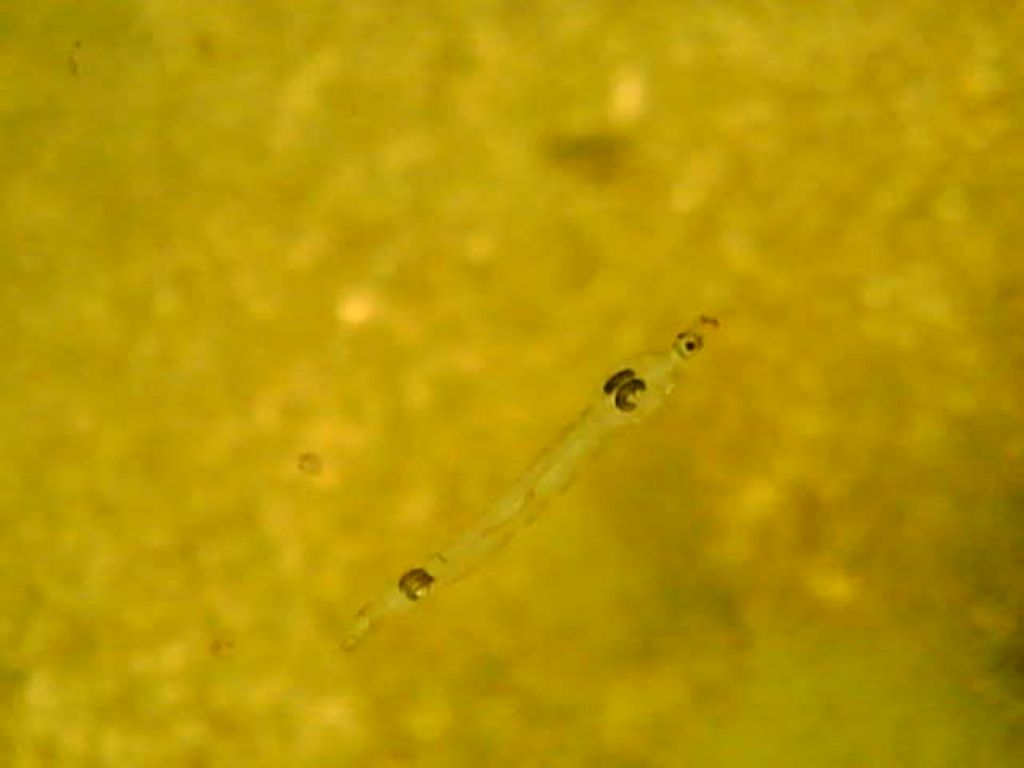 ID.: Larva Dittero (Chaoborus?)
